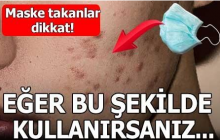 Tıbbi maskeler sivilce yapar mı?