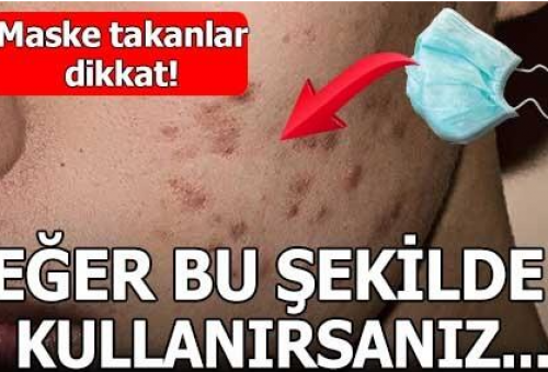 Tıbbi maskeler sivilce yapar mı?